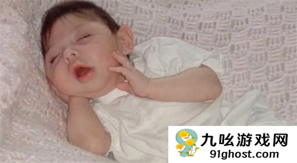 被医生断言活不过5岁 美国天生无脑女子创最长存活记录