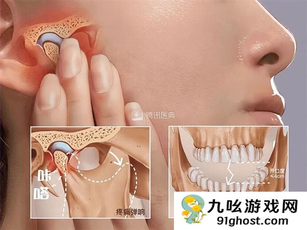 00后女生一觉醒来无法张嘴：确诊“TM  D”