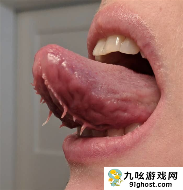 男子舌头天生异常：下面竟然长着两条“流苏”！