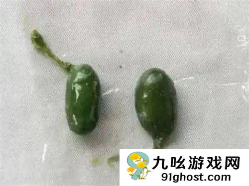 女子生吞鱼胆降火导致肝衰竭 医生：毒性堪比砒霜 无解药