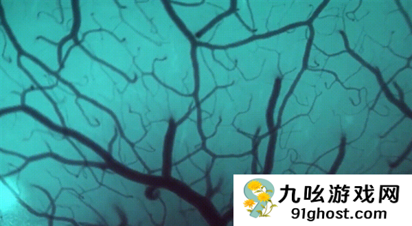 1.5秒植入！马斯克脑机接口公司技术新突破 超万人等待上脑