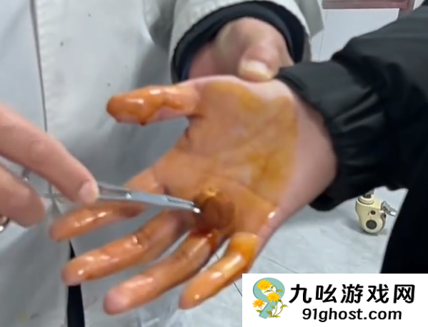 男子徒手摸灭火毯双手被刺钻心疼：主体材质玻璃纤维 需握黑色拉带